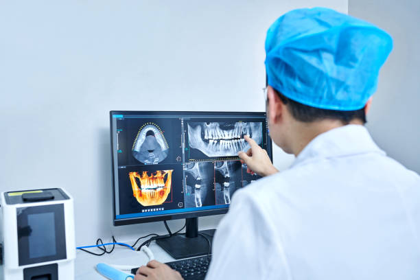 Best Emergency Wisdom Teeth Removal in Belterra, TX
